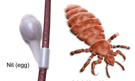Ketchikan School Board to discuss lice policy