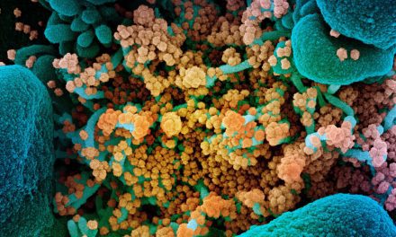 Ketchikan seafood processing plant worker tests positive for COVID-19