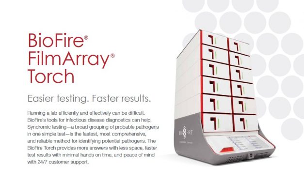 Rapid testing machine headed for Ketchikan could speed local & regional COVID-19 results, provider says