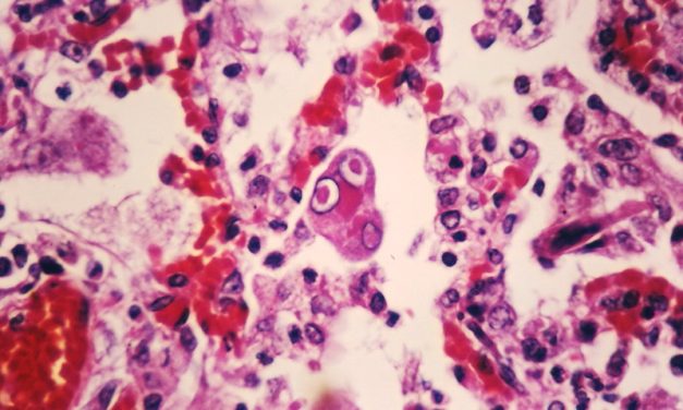 Sitka clinic awaiting lab results on potential measles exposure