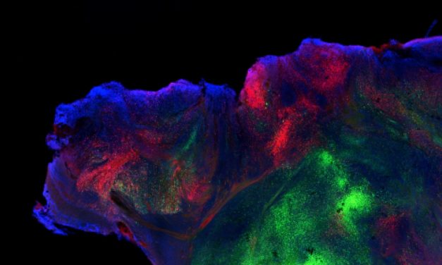 Mice with human brain cells offer a tool to study disease. Ethicists ask: What’s next?