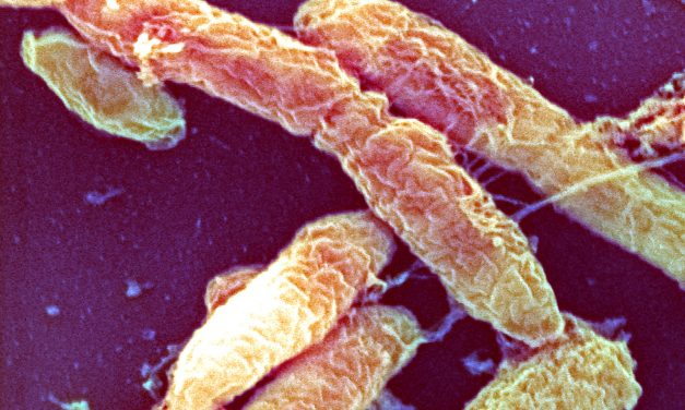 What is the pneumonic plague?
